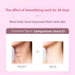 LED Neck Tightening Massager Anti Aging Skin Care Device Tool