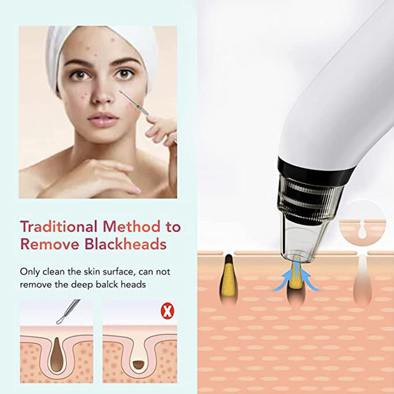 Ultrasonic Blackhead Remover &  Pore Vacuum Cleanser for Women —  3-Level Suction | USB Rechargeable