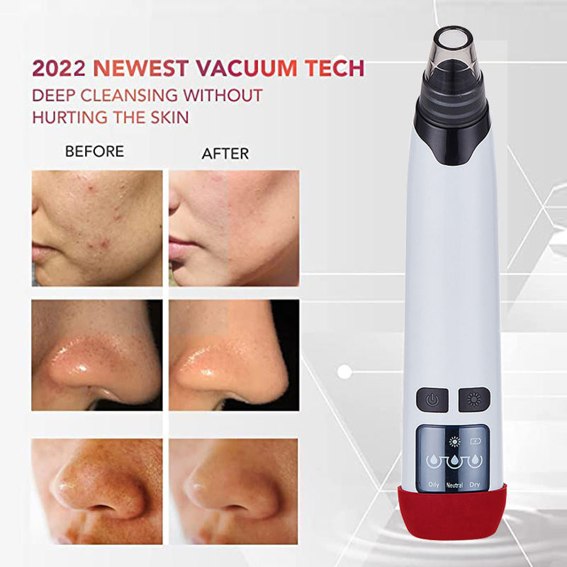 Ultrasonic Blackhead Remover &  Pore Vacuum Cleanser for Women —  3-Level Suction | USB Rechargeable